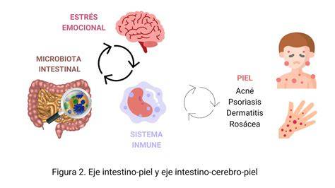 Eje intestino-piel e inflamación del acné