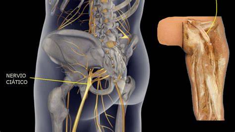 anatomía músculo piriforme nervio ciático