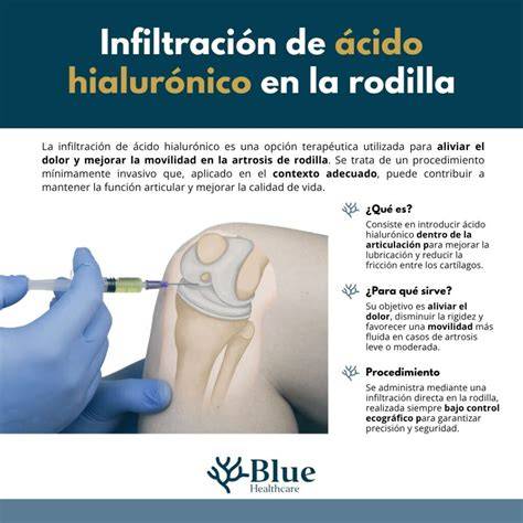 Infiltración de ácido hialurónico