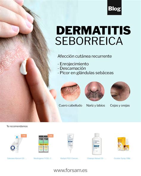Dermatitis seborreica en cuero cabelludo y rostro
