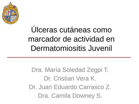 Úlceras cutáneas en dermatomiositis