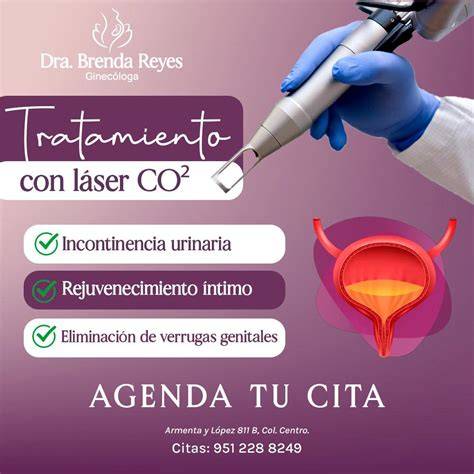 Esquema del láser CO₂ vaginal fraccionado