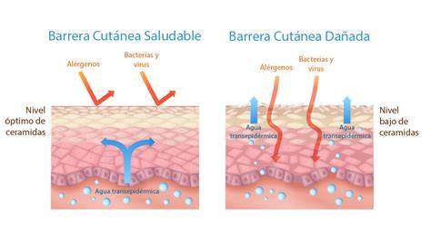 piel atópica barrera cutánea microbioma