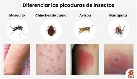 Marcas rojas por picaduras de mosquito en piernas