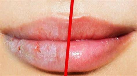 Labios secos antes de exfoliar