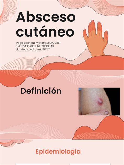 Absceso cutáneo y cuidados higiénicos