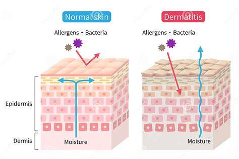 piel seca y eczema antes después