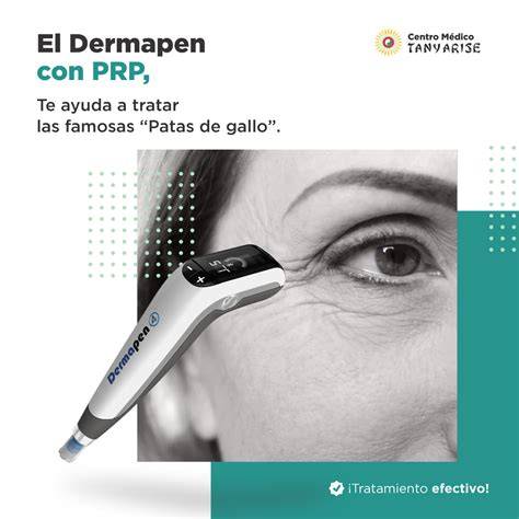 Dermapen para patas de gallo