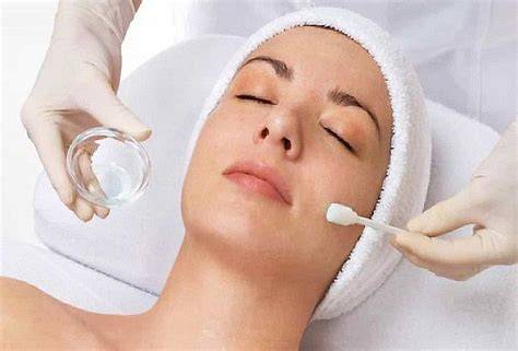Aplicación de peeling químico facial