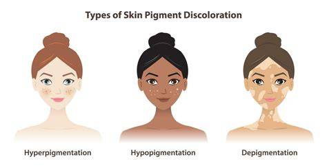 Comparación entre hiperpigmentación e hipopigmentación